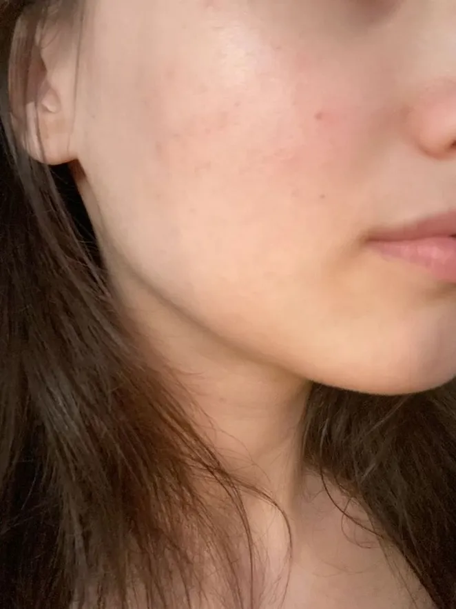 Before Image